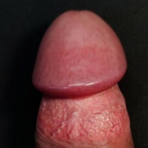 Profile picture of Teddy